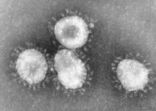 200 سلالة للأنفلونزا وكرونا يهدد ناقصي المناعة