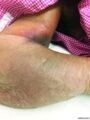 مواطن يتهم أطباء بمستشفى بتعنيف والدته المسنة والتسبب في كسر يدها.. و”صحة بيشة” ترد