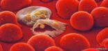 “الصحة”: تعرّف على مرض الملاريا.. أعراضه وطرق مكافحته والوقاية منه