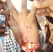 طلاب هنود يقطعون يد محاضر جامعي أساء للرسول الكريم