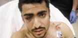 اعتداء وحشي على طالب سعودي في ميزوري الأمريكية