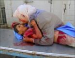 من ضحايا مجزرة حماه..طفل يصارع الموت بين احضان امه