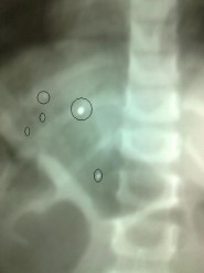 عاجل : حادث على المدخل الشرقي يخلف عدد من الإصابات