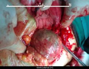 الشورى يقر رسميا برفع قيمة القرض العقاري إلى 500 ألف ريال وتوحيده لكل المناطق والمحافظات