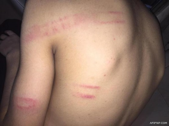 حالة الطقس المتوقعة اليوم الجمعة