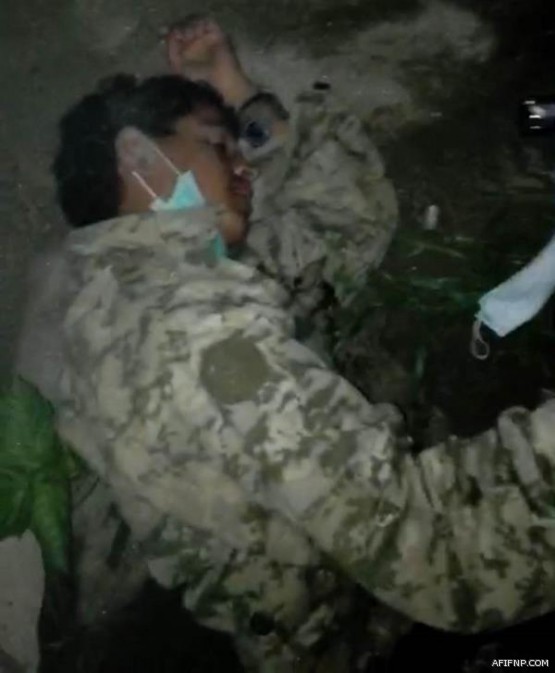 “لعبة” في فندق شهير بدبي تصيب شاباً سعودياً بعاهة مستديمة وتقعده لأكثر من عام