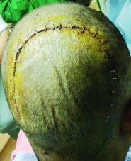 المعهد المهني بعفيف يقيم  دورة تدريبية عن وسائل السلامة لطلابه