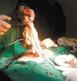 حالة الطقس المتوقعة اليوم الجمعة