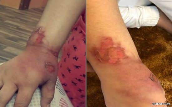 «تعليم الطائف» يحقق في اعتداء طالب على معلمه