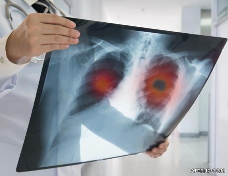 “الإحصاء”: ارتفاع نصيب الفرد من الناتج المحلي 14% وارتفاع الادخار الإجمالي 29% خلال الربع الثاني