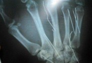 المتحدث الرسمي : الاجازة تشمل جميع معلمي ومعلمات المملكة ولا تشمل موظفي التربية والتعليم